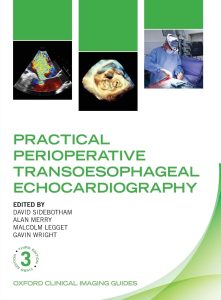 Practical Perioperative Transoesophageal Echocardiography (Oxford Clinical Imaging Guides) 3rd Edition