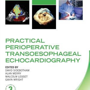 Practical Perioperative Transoesophageal Echocardiography (Oxford Clinical Imaging Guides) 3rd Edition