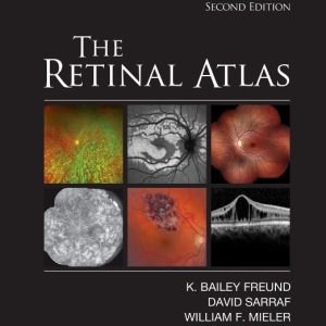 The Retinal Atlas 2nd Edition