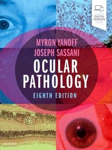 Ocular Pathology Eighth Edition