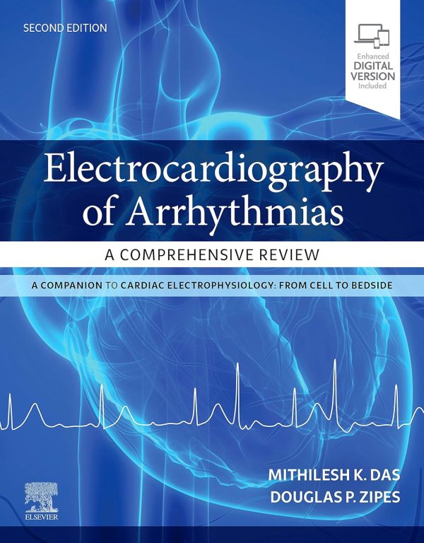 Electrocardiography of Arrhythmias: A Comprehensive Review: A Companion to Cardiac Electrophysiology 2nd Edition