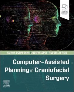 Computer-Assisted Planning in Craniofacial Surgery First Edition