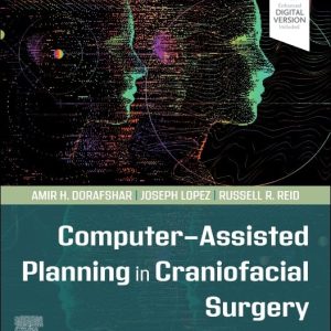 Computer-Assisted Planning in Craniofacial Surgery First Edition