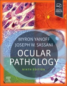 Ocular Pathology Ninth Edition