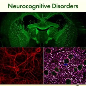 HIV-Associated Neurocognitive Disorders 1st Edition