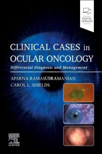 Clinical Cases in Ocular Oncology Differential Diagnosis and Management First Edition