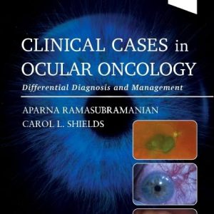 Clinical Cases in Ocular Oncology  Differential Diagnosis and Management First Edition