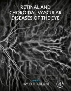 Retinal and Choroidal Vascular Diseases of the Eye First Edition