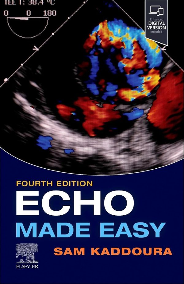 Echo Made Easy 4th Edition