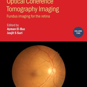 Photo Acoustic and Optical Coherence Tomography Imaging: Fundus Imaging for the Retina (Volume 2)