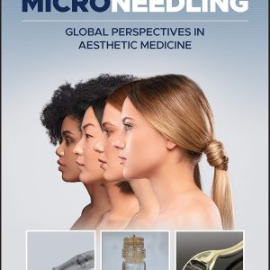 Microneedling Global Perspectives in Aesthetic Medicine First Edition