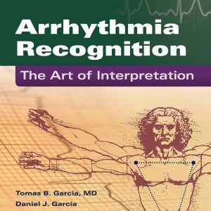 Arrhythmia Recognition: The Art of Interpretation: 2nd Edition