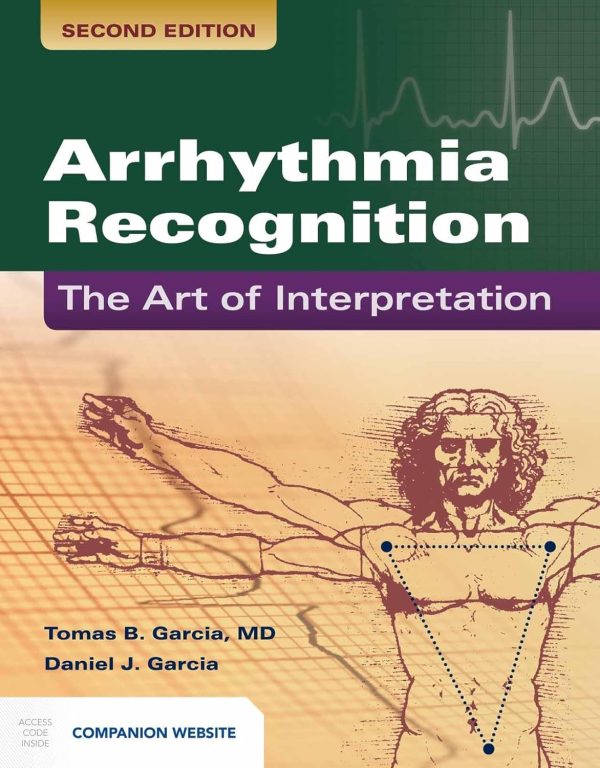 Arrhythmia Recognition: The Art of Interpretation: 2nd Edition