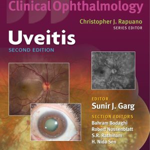 Uveitis (Color Atlas and Synopsis of Clinical Ophthalmology) Second Edition