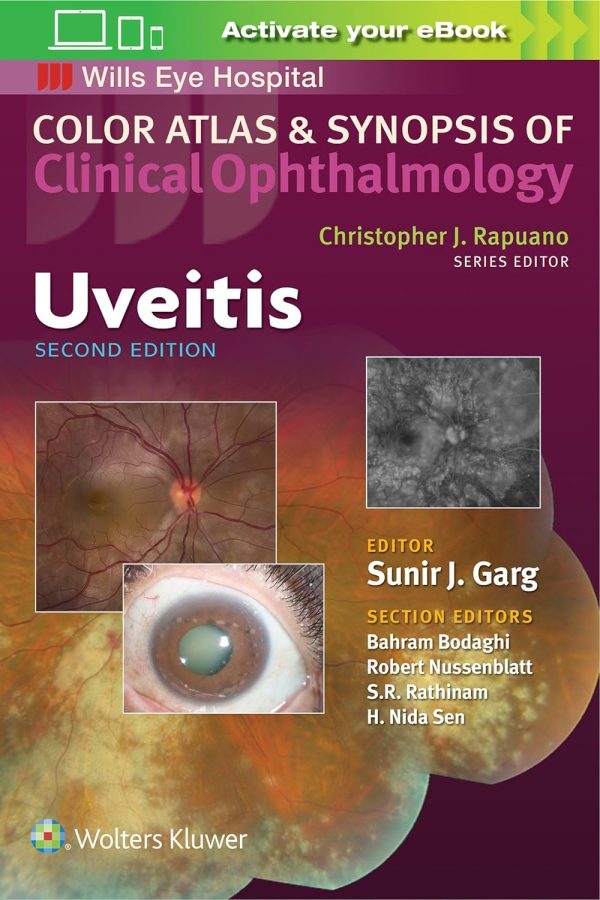 Uveitis (Color Atlas and Synopsis of Clinical Ophthalmology) Second Edition