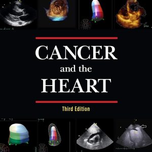 Cancer and the Heart 3rd Edition