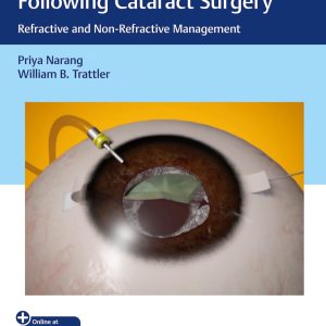 Optimizing Suboptimal Results Following Cataract Surgery: Refractive and Non-Refractive Management 1st Edition