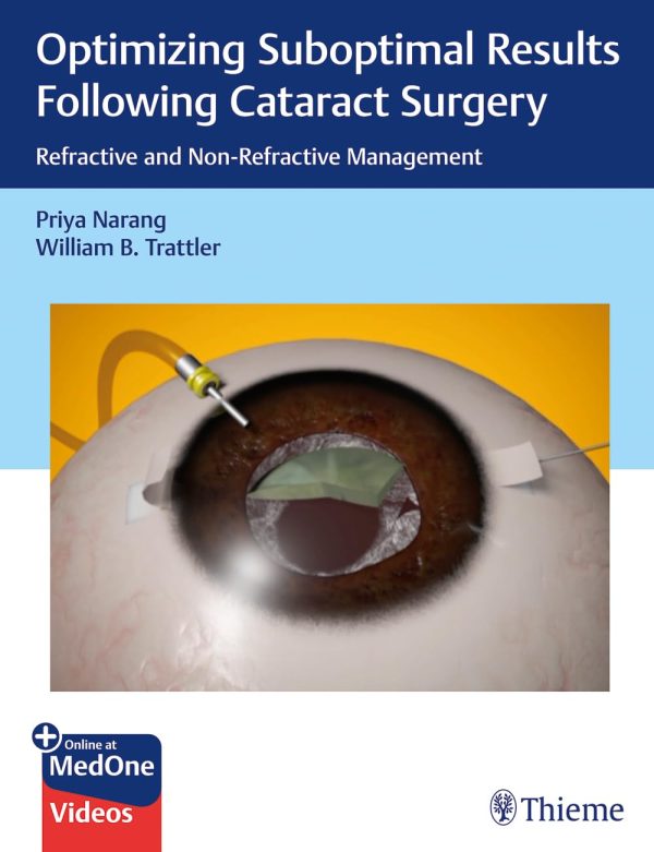 Optimizing Suboptimal Results Following Cataract Surgery: Refractive and Non-Refractive Management 1st Edition