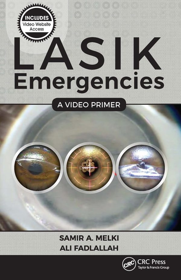 LASIK Emergencies A Video Primer First Edition