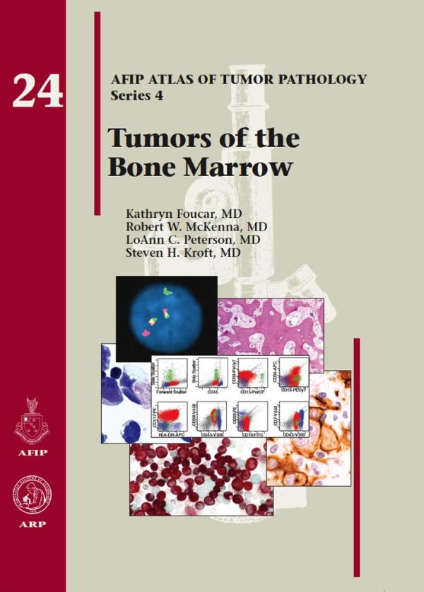 TUMORS OF THE BONE MARROW (4F24) 1st Edition