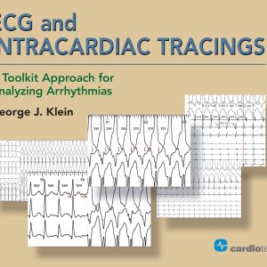 ECG and Intracardiac Tracings: A Toolkit Approach for Analyzing Arrhythmias  1st Edition