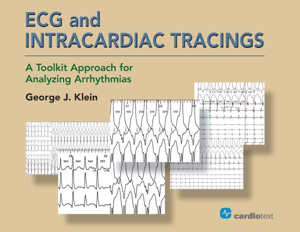 ECG and Intracardiac Tracings: A Toolkit Approach for Analyzing Arrhythmias  1st Edition