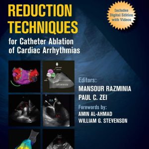 Fluoroscopy Reduction Techniques for Catheter Ablation of Cardiac Arrhythmias 1st Edition