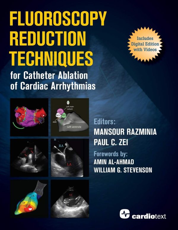 Fluoroscopy Reduction Techniques for Catheter Ablation of Cardiac Arrhythmias 1st Edition