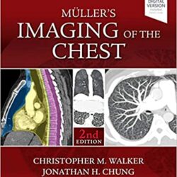 Muller’s Imaging of the Chest: Expert Radiology Series 2nd Edition