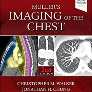Muller's Imaging of the Chest: Expert Radiology Series 2nd Edition