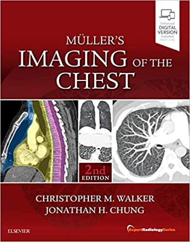 Muller’s Imaging of the Chest: Expert Radiology Series 2nd Edition