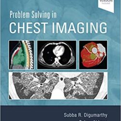 Problem Solving in Chest Imaging E-Book – Original PDF