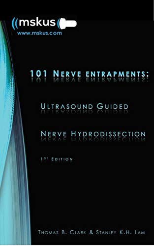 101 Aprisionamentos Nervosos: Hidrodissecção Nervosa Guiada por Ultrassom 1ª Edição