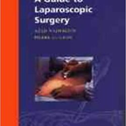 A Guide to Laparoscopic Surgery 1st Edition