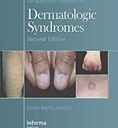 An Illustrated Dictionary of Dermatologic Syndromes