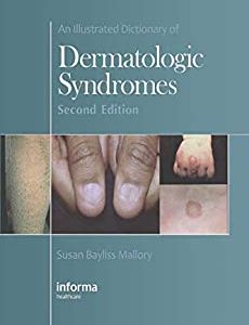 An Illustrated Dictionary of Dermatologic Syndromes