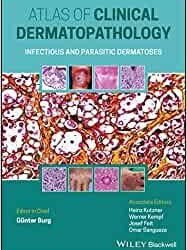 Atlas Clinical of Dermatopathology: Infectious and Parasitic Dermatoses 1st Edition
