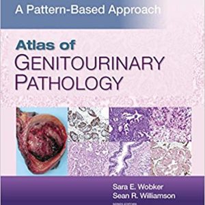 Atlas of Genitourinary Pathology: A Pattern Based Approach,1st Edition by Sara E. Wobker.