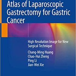 Atlas de la gastrectomie laparoscopique pour le cancer gastrique : image haute résolution pour une nouvelle technique chirurgicale