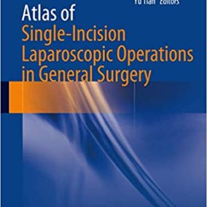 Atlas of Single-Incision Laparoscopic Operations in General Surgery