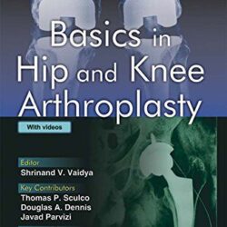 Basics in hip and knee Arthroplasty