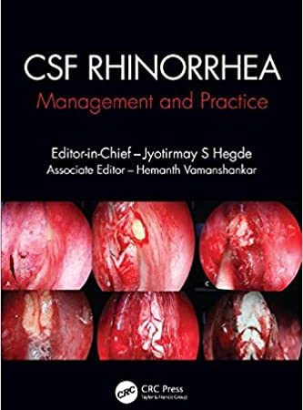 CSF Rhinorrhoea: Management and Practice 1st Edition