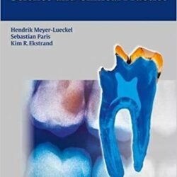 Caries Management – Science and Clinical Practice 1st Edition