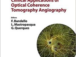 Clinical Applications of Optical Coherence Tomography Angiography (ESASO  Vol. 11).