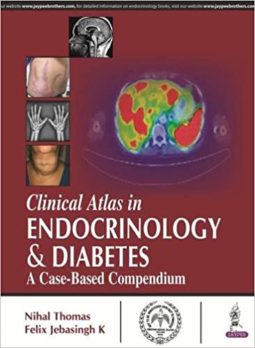 Atlas clinique en endocrinologie et diabète (un recueil basé sur des cas) 1ère édition