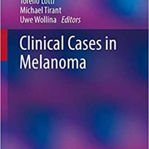 Clinical Cases in Melanoma (Clinical Cases in Dermatology) 1st ed. 2020 Edition