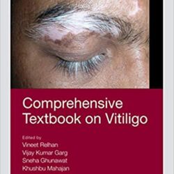 Umfassendes Lehrbuch über Vitiligo 1. Auflage