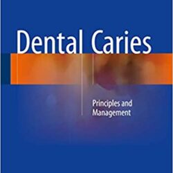 Dental Caries: Principles and Management 1st ed. 2016 Edition