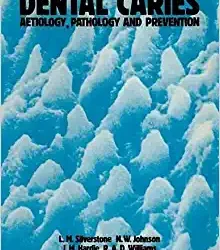 Dental Caries Aetiology, Pathology and Prevention  June 1, 1981