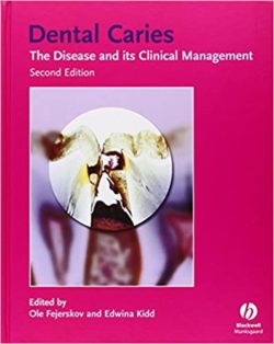 Dental Caries: The Disease and Its Clinical Management 2nd Edition